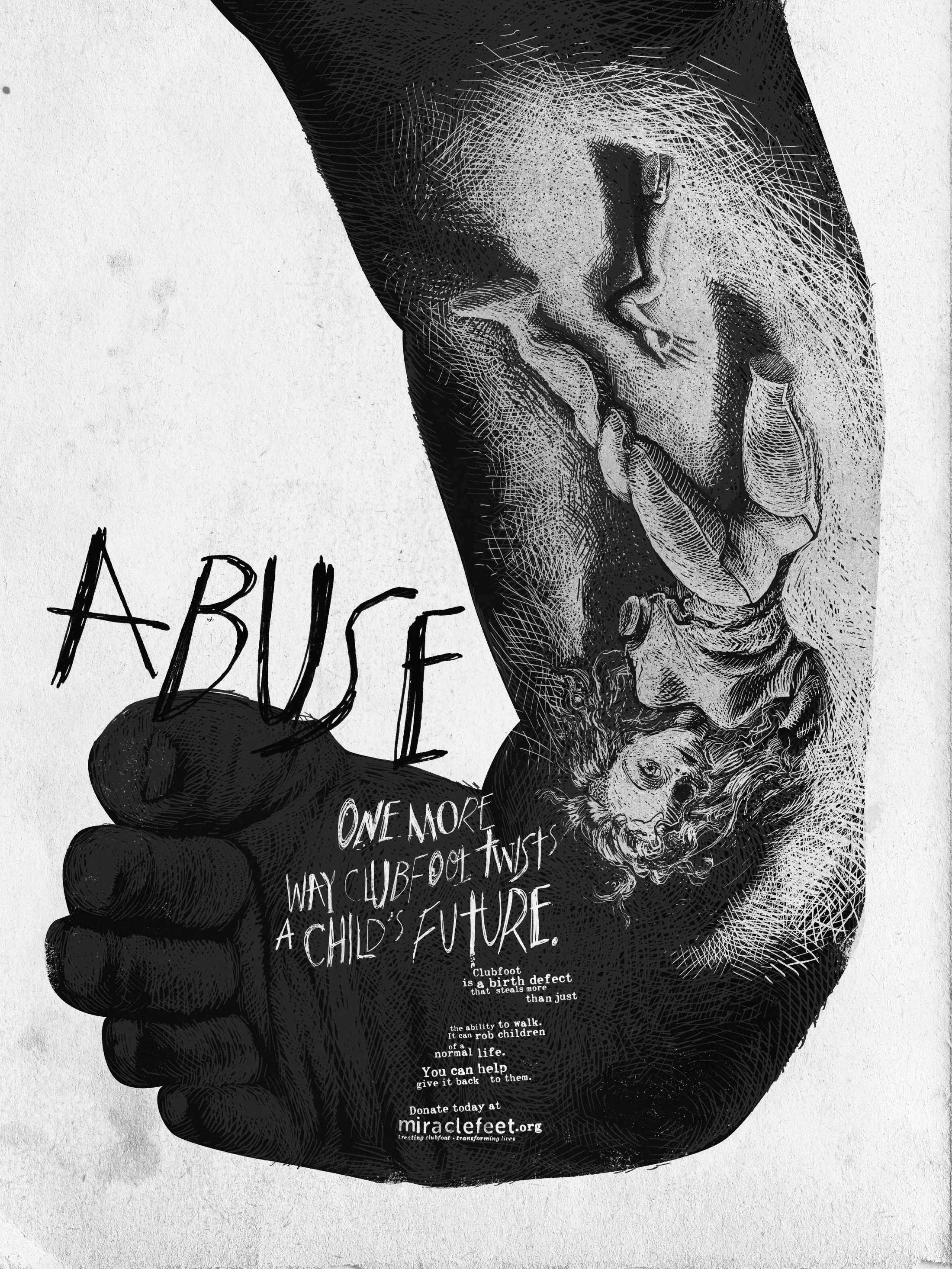 Thumbnail for Abuse
