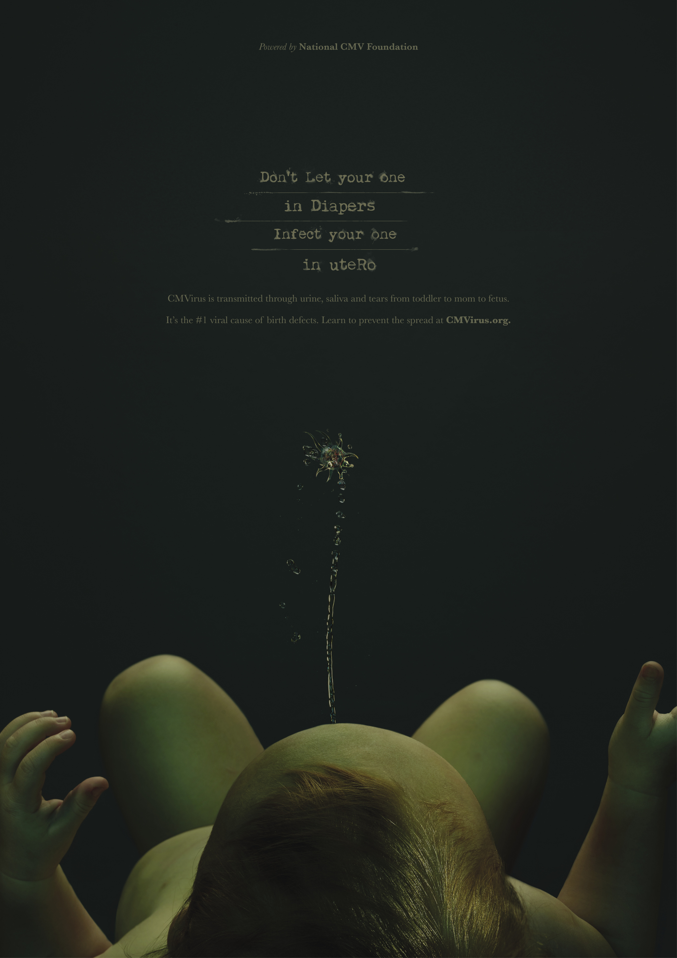 Thumbnail for Urine