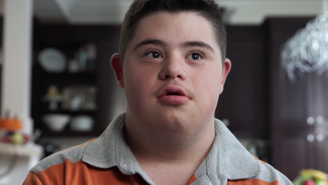 Thumbnail for Down Syndrome Answers